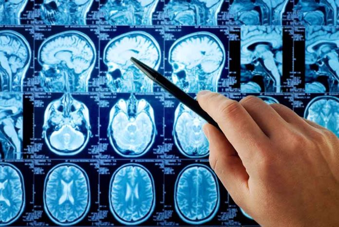 Dead Athlete's Brain Scan Shows Signs of CTE Dead Athlete's Brain Scan Shows Signs of CTE