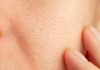 Close-up of a persons cheek with visible pores