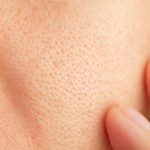 Close-up of a persons cheek with visible pores