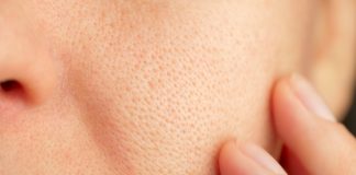 Close-up of a persons cheek with visible pores