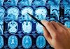 Hand pointing at brain scan images on screen