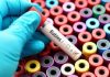 Rabies Bombshell Exposes Transplant Safety Meltdown A hand in a blue glove holding a blood test tube labeled Rabies over colorful sample containers