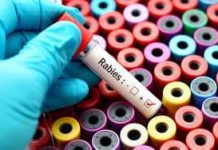 Rabies Bombshell Exposes Transplant Safety Meltdown A hand in a blue glove holding a blood test tube labeled Rabies over colorful sample containers