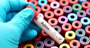 A hand in a blue glove holding a blood test tube labeled Rabies over colorful sample containers