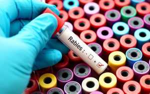 rabies-know-the-facts-300x188.jpg A hand in a blue glove holding a blood test tube labeled Rabies over colorful sample containers